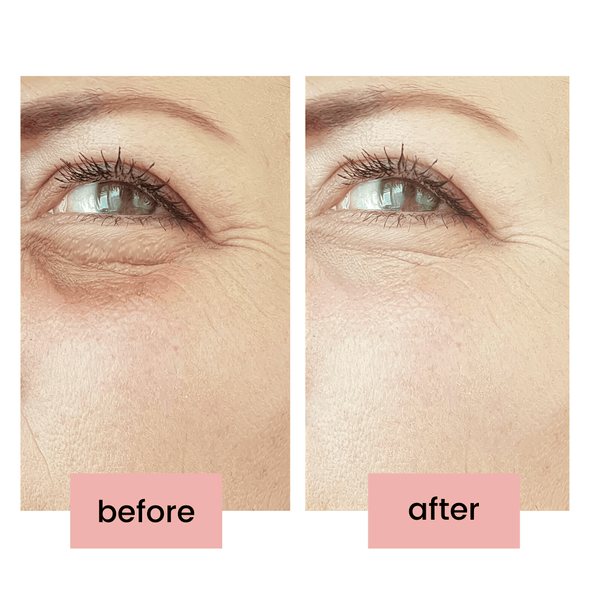 skinreverse eyecare before and after